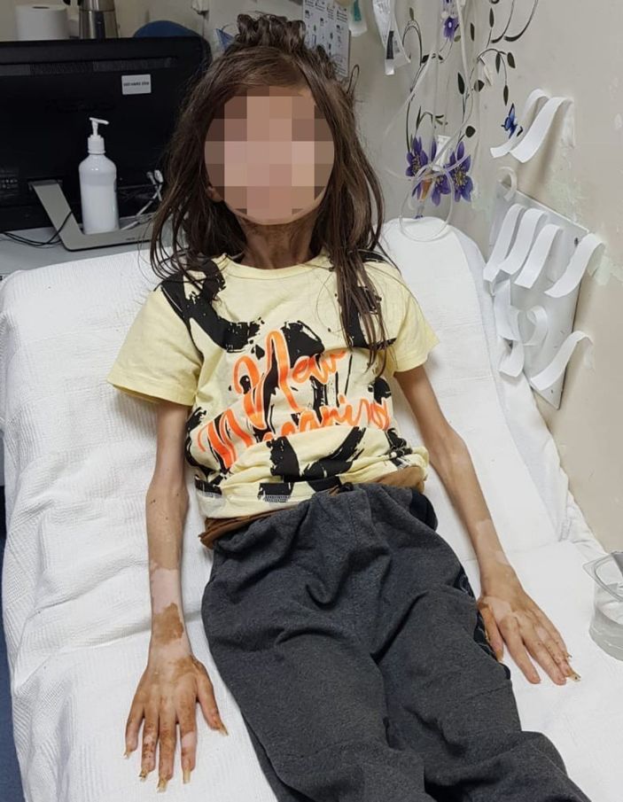 i Bursa’da çöp evde bulunan Cem Muhammet ile ilgili sevindiren gelişme -4