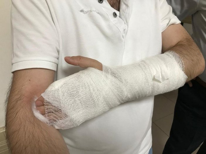 Kayseri'de avukata bıçakla saldırı -2