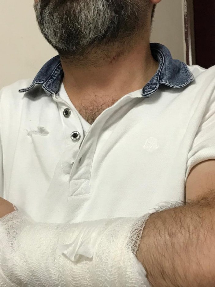 Kayseri'de avukata bıçakla saldırı -3