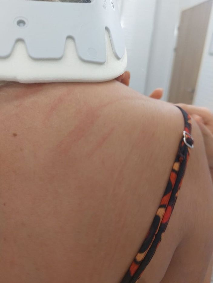 Köpek havlamasından rahatsız olduğu gerekçesiyle hayvansever kadını darbetti -4