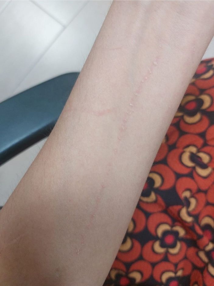 Köpek havlamasından rahatsız olduğu gerekçesiyle hayvansever kadını darbetti -5