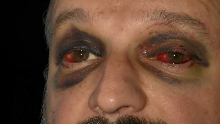 Müzisyeni, ikinci kez 'çiftetelli' çalmayınca döven 9 kişi serbest -1