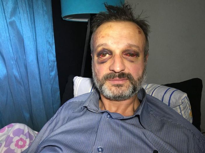 Müzisyeni, ikinci kez 'çiftetelli' çalmayınca döven 9 kişi serbest -5