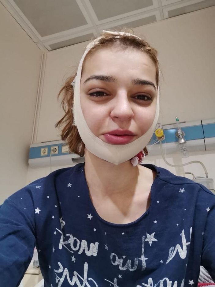 Şiddet mağduru kadından eski kocaya suç duyurusu -2