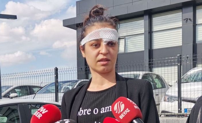 Şiddet mağduru kadından eski kocaya suç duyurusu -1