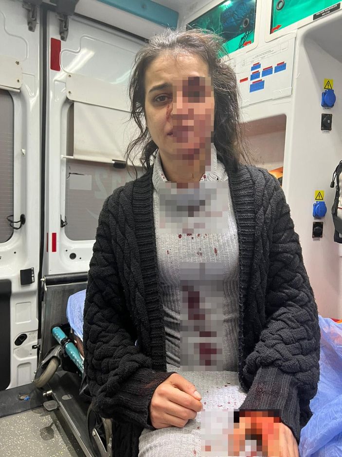 Şiddet mağduru kadından eski kocaya suç duyurusu -3