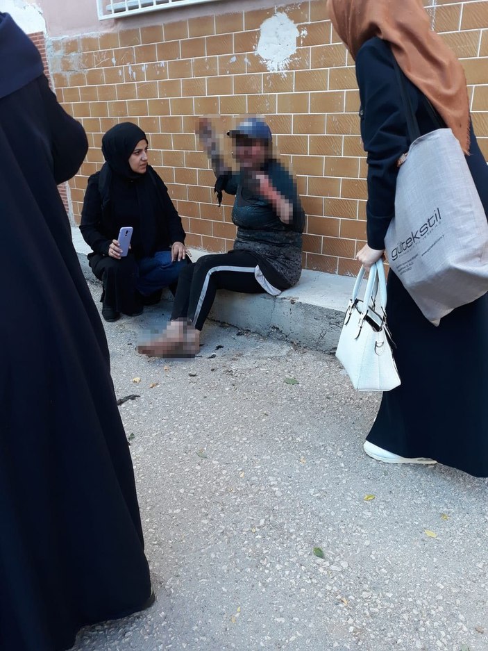 Yemek yaparken mutfakta çıkan yangında ağır yaralandı -1