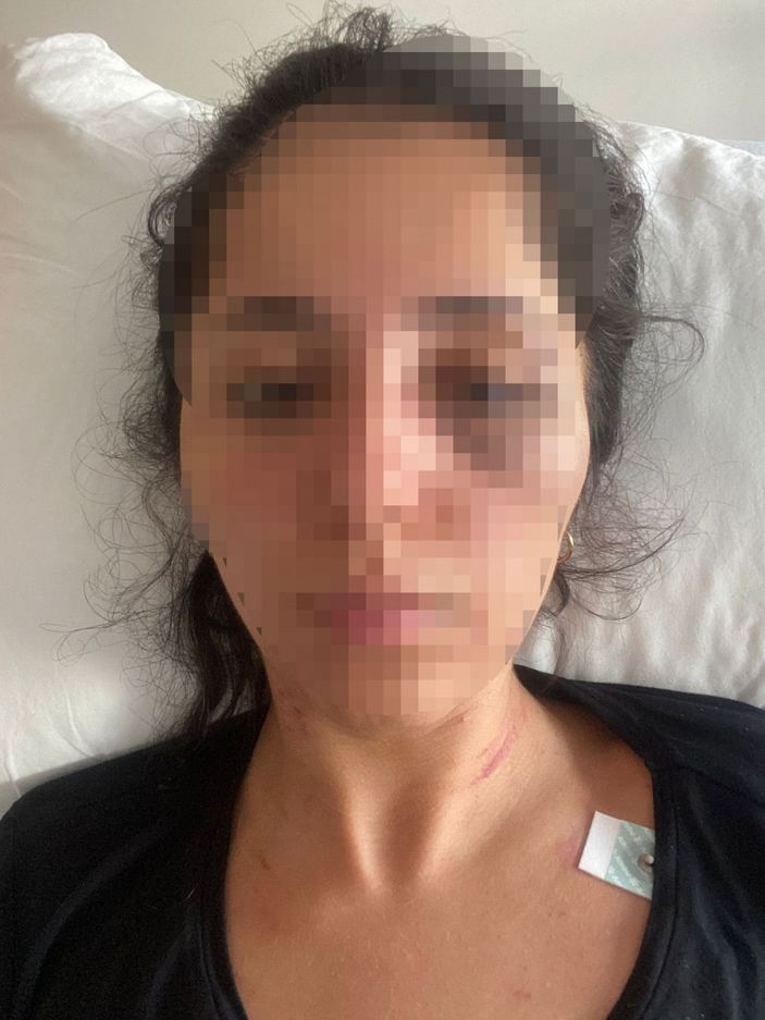 Sevgilisini dövüp 5 yerinden bıçaklayan doktora 20 yıl hapis istemi -3