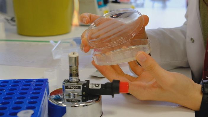 Kanser tedavisinde Türk doktorlardan tarihi buluş