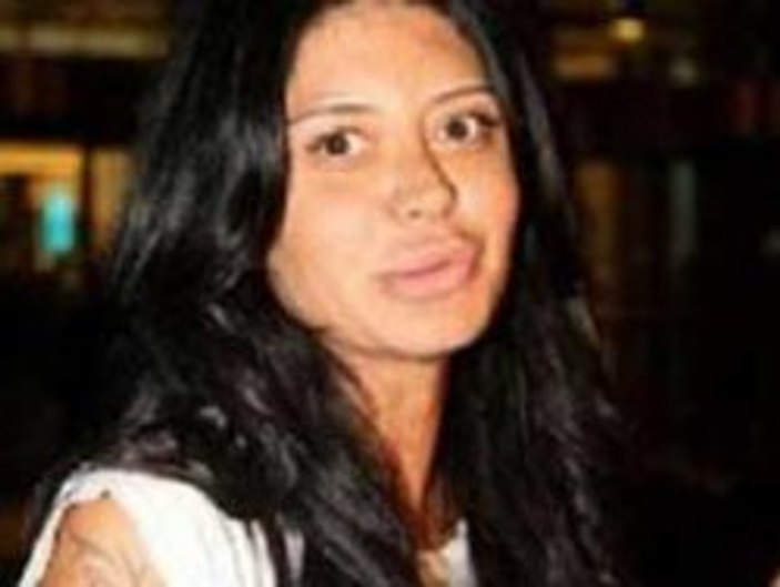 Ebru Polat tanınmaz halde