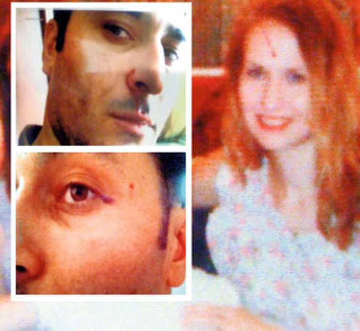 Bu kez erkeğe şiddet: Karım içip içip beni dövüyor