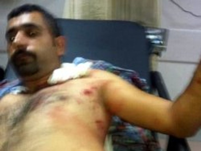 HDK'nın Rojava eylemine bıçaklı saldırı