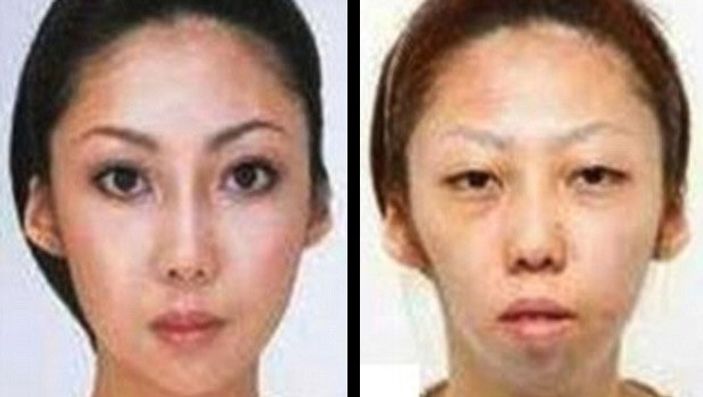 Estetik yaptırdığını saklayan eşe tazminat davası