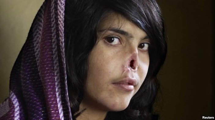 Afganistan'da kadın olmak