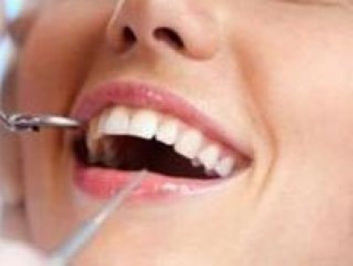 Dişler için görünmeyen tel dönemi