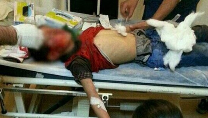 10 yaşındaki Mehmet Ezer polis müdahalesinde yaralandı