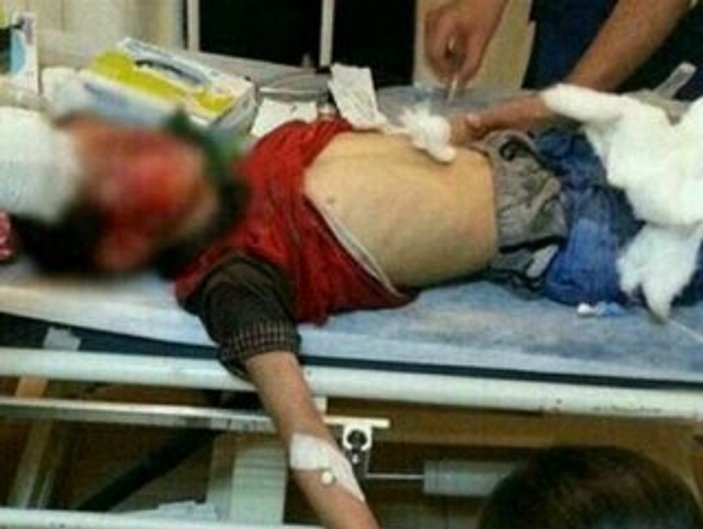 10 yaşındaki Mehmet Ezer polis müdahalesinde yaralandı