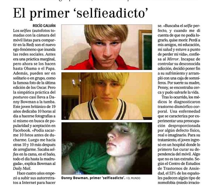 Dünyanın ilk selfie bağımlısı ölümün eşiğine geldi