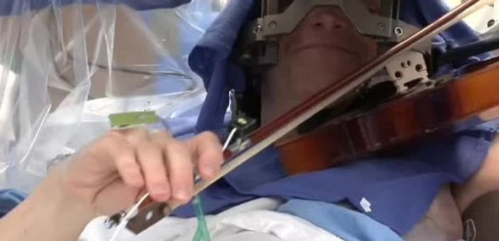 Müzisyen beyin ameliyatı olurken keman çaldı