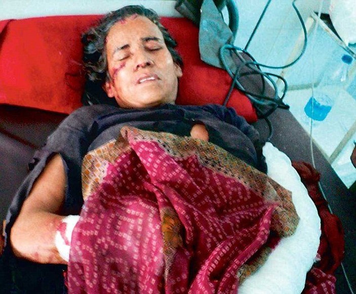 Hindistan'da bir kadına leopar saldırdı