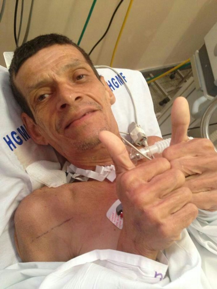 Brezilya'da ölü sanılan adam morgda canlandı