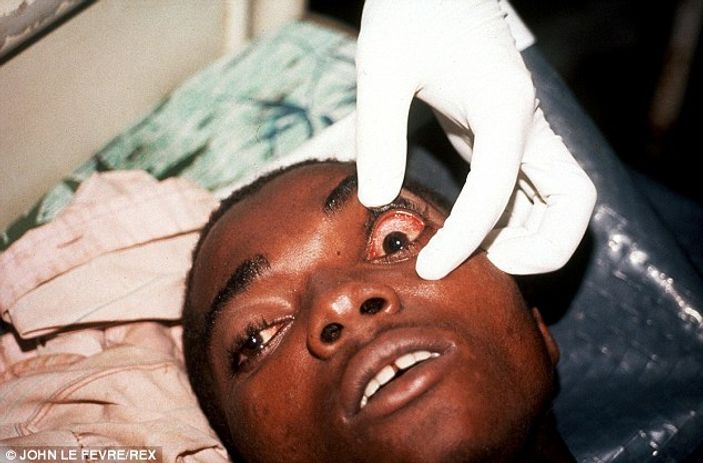 Madde madde ölümcül Ebola virüsü