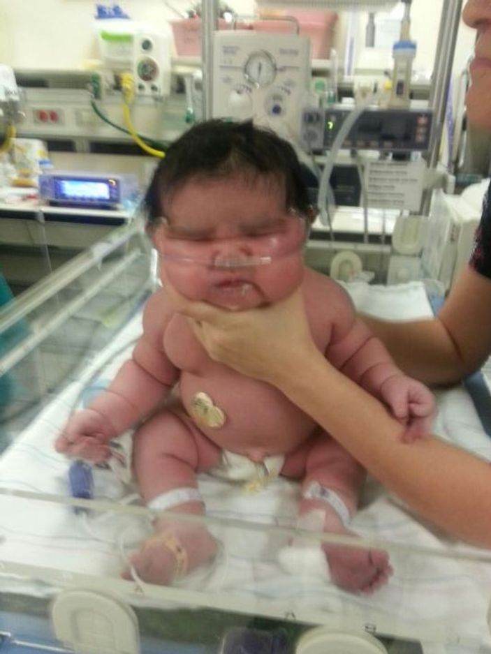 ABD'de 6 kiloluk bir bebek doğdu