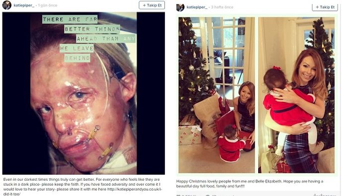 Katie Piper'in yeni yüzü