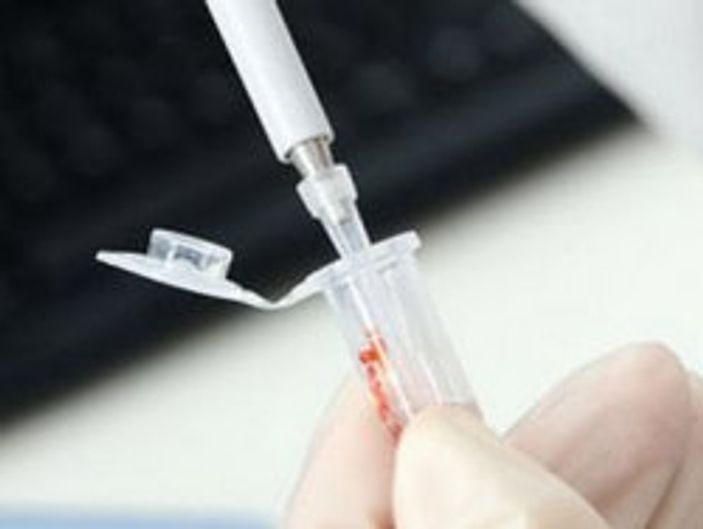 Kanada'da kuş gribi vakası