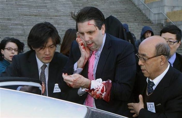 Kuzey Kore'den usturalı saldırı açıklaması: Hak etti