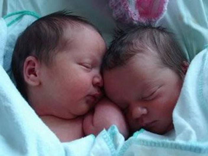 ikiz bebek