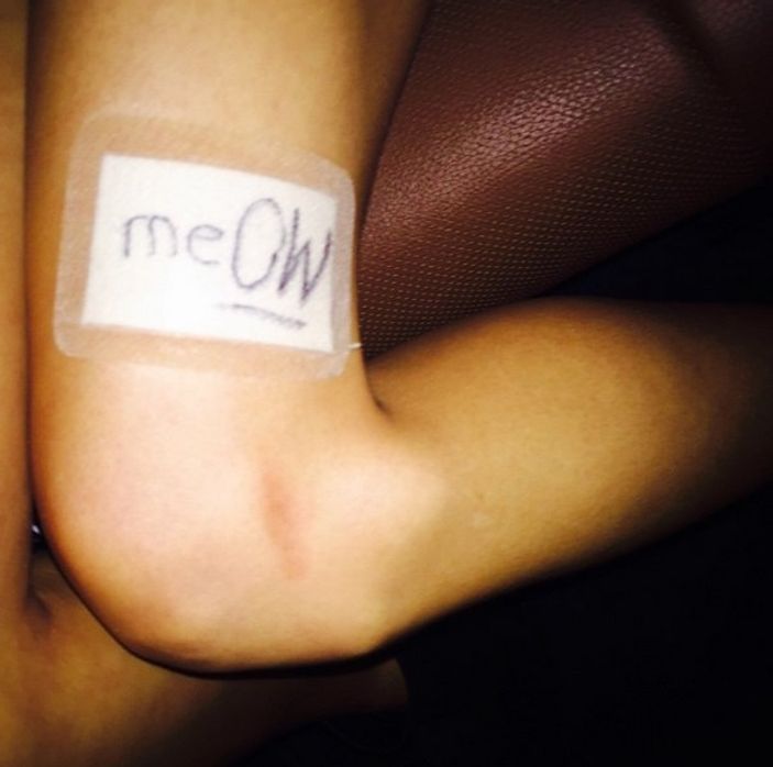 Kedisi Taylor Swift'in 40 milyon dolarlık bacağını çizdi