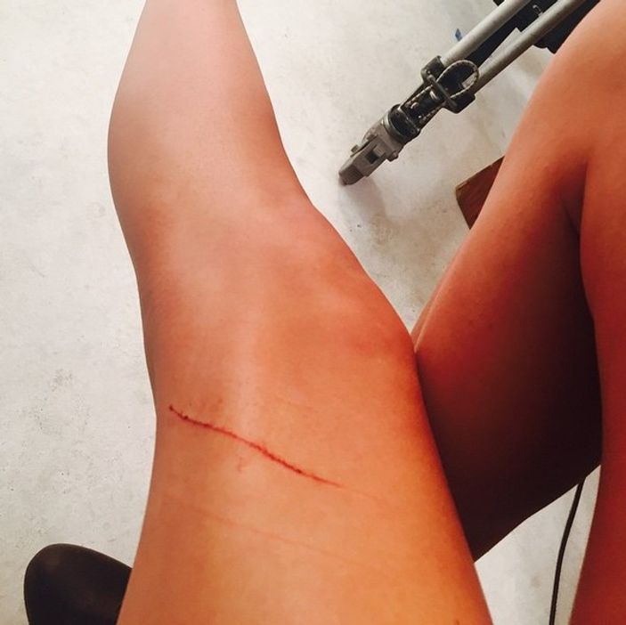 Kedisi Taylor Swift'in 40 milyon dolarlık bacağını çizdi