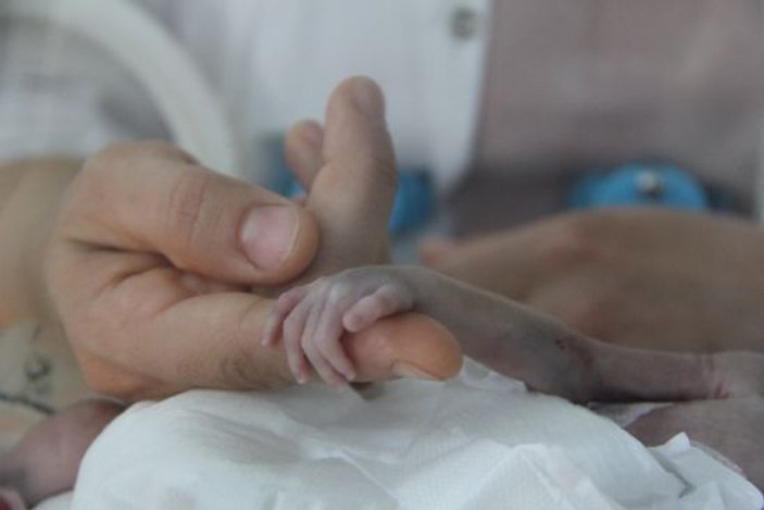 500 gram doğan parmak bebek hayata tutundu