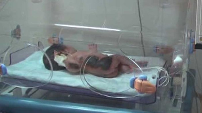 Siirt'te yeni doğan bebeği ısıtıcıda unuttular
