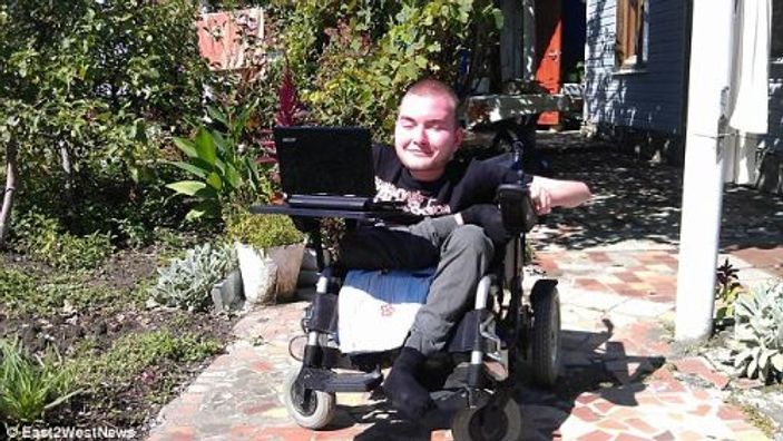 İtalyan cerrah dünyanın ilk kafa naklini yapacak