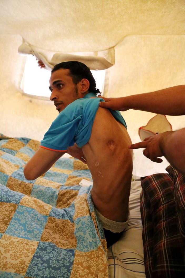 Savaşın engelli yaşamaya mahkum ettiği Suriyeliler