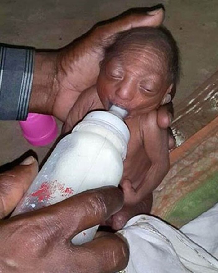 Hindistan'da hasta doğan bebeği anne ve babası terk etti
