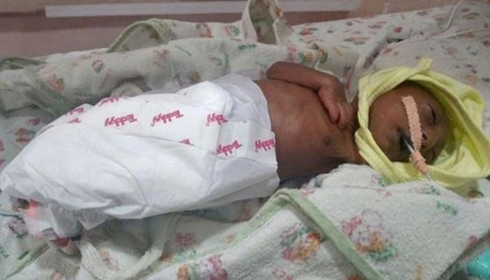 Hindistan'da hasta doğan bebeği anne ve babası terk etti