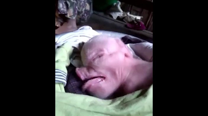 ABD'de domuz suratlı bebek doğdu