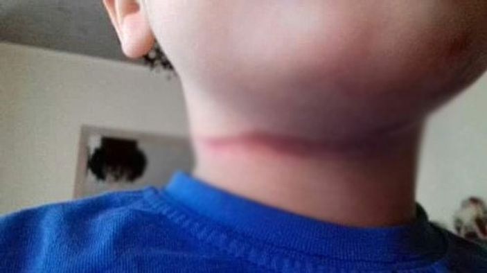 Belçika'da öğretmen öğrencisini darp etti