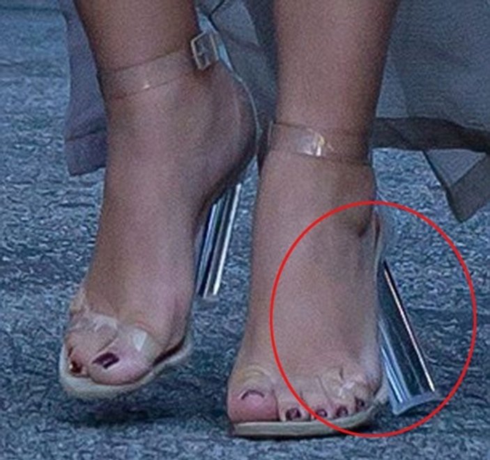 Topuklu ayakkabısı Kim Kardashian'ı taşımadı