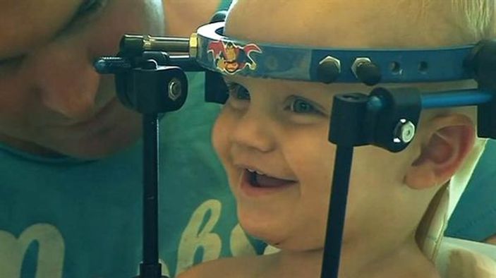 Başı kopan bebek kurtarıldı