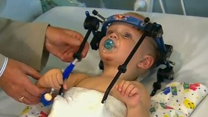 Başı kopan bebek kurtarıldı