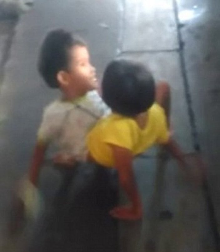 Tayland'da 7 yaşındaki yapışık ikizler