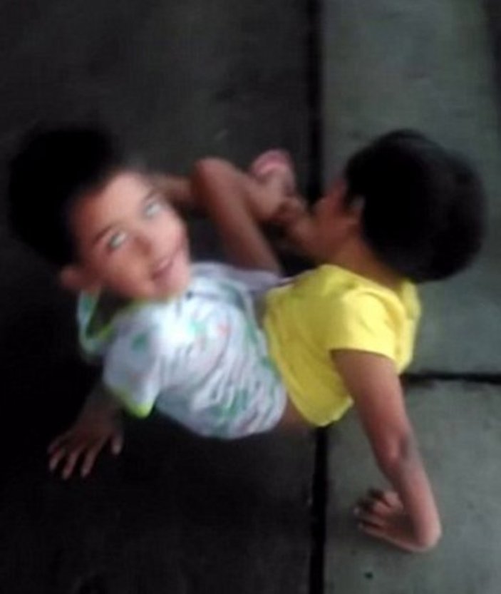 Tayland'da 7 yaşındaki yapışık ikizler