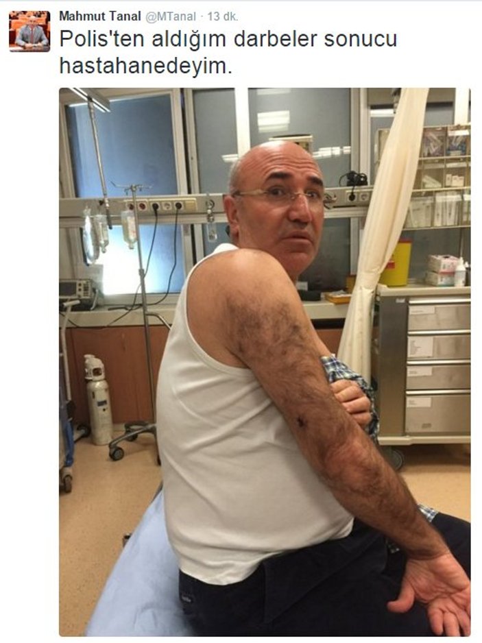 CHP'li Mahmut Tanal'dan polis beni dövdü pozu