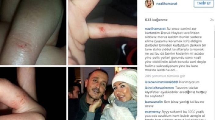 Sevgilisi Nazlı Hamarat'ı dövdü