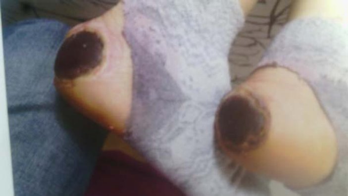 Özel hastanede doğum yapan kadının ayaklarını yaktılar