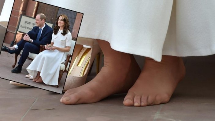 İngiltere'nin gündemi: Kate Middleton'ın nasırlı ayakları